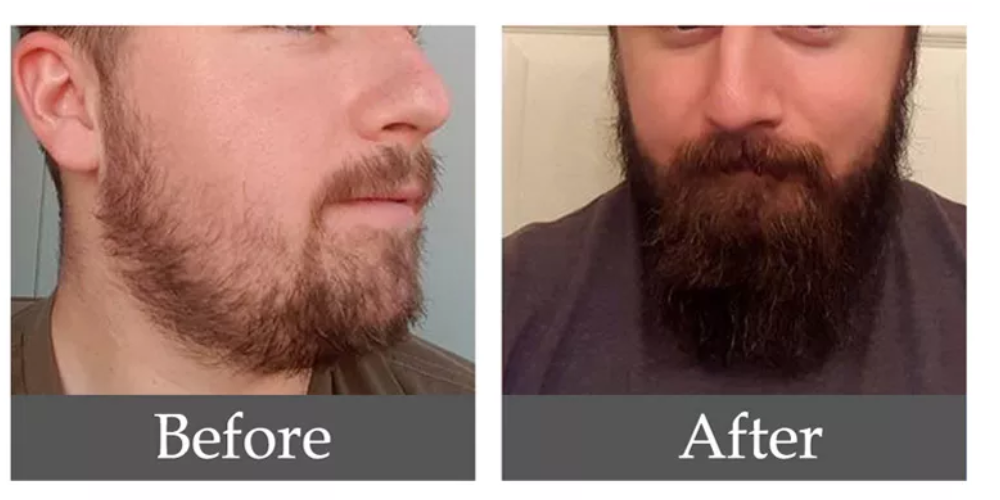 Stunning Norse Beard Growth Serum Photo Art